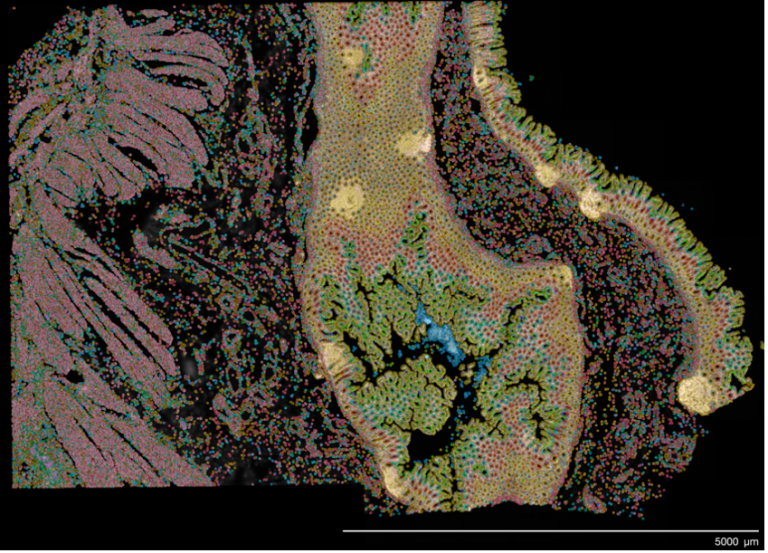 Xenium Spatial Profiling Technology – OSTR